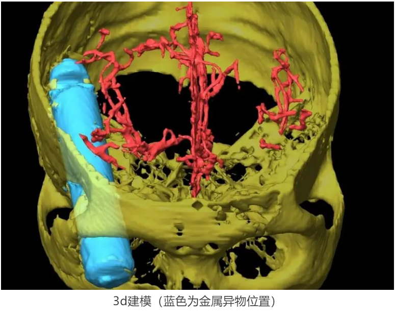 1611283371372382.png 圖片.png